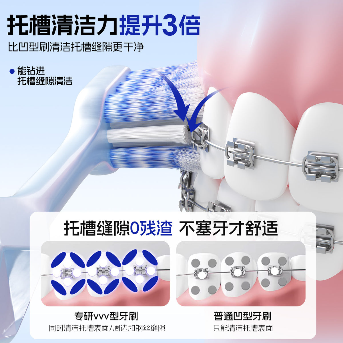 Mixuan W-Shaped Orthodontic Toothbrush for Correcting Teeth, with Soft Bristles and Small Head for Cleaning between Teeth, Suitable for Teenagers - image 2