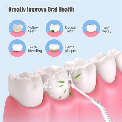 Electric Dental Flosser, Water Flosser, Tooth Cleaning Device, Dental Calculus Remover, Orthodontic Special Tool, Portable, Powerful, Cross-Border - image 3