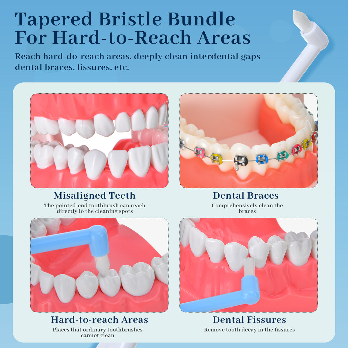 Single-Beam Brush orthodontic toothbrush small pointed flat head orthodontic braces special dental implant portable small head medium brush - image 3